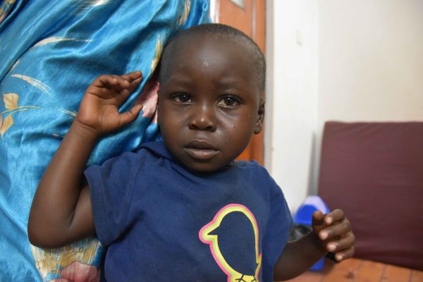 Asira Joseph billede før operation